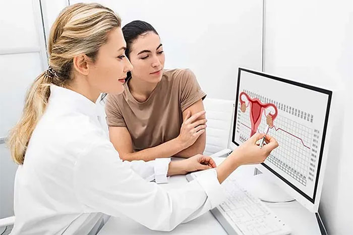 همه چیز درباره سندرم تخمدان پلی کیستیک
